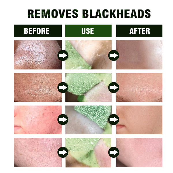 Green Tea Purée Face Mask – Hydrating & Purifying Skincare Treatment