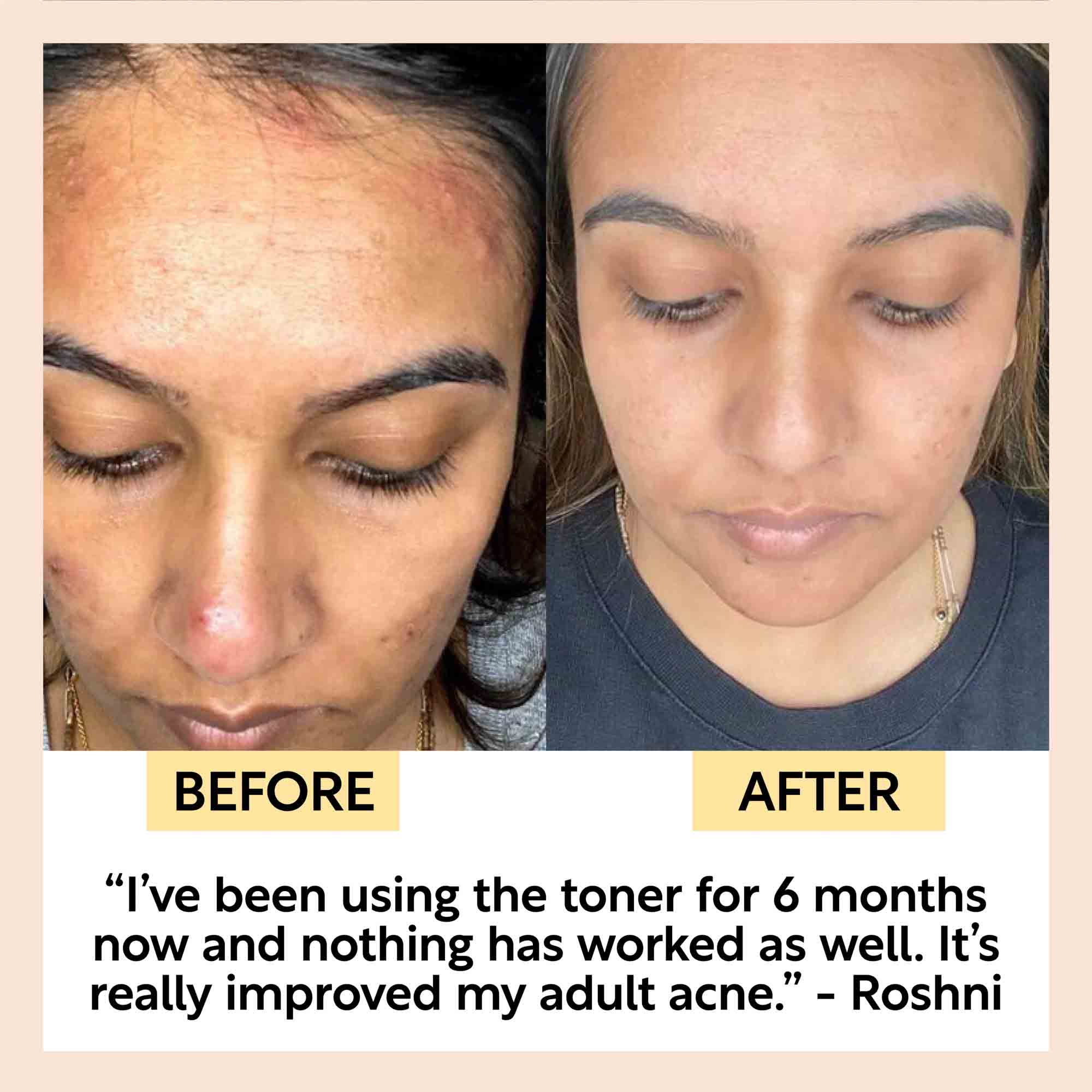 Face Toner with Hyaluronic Acid – Hydrating Daily Facial Toner